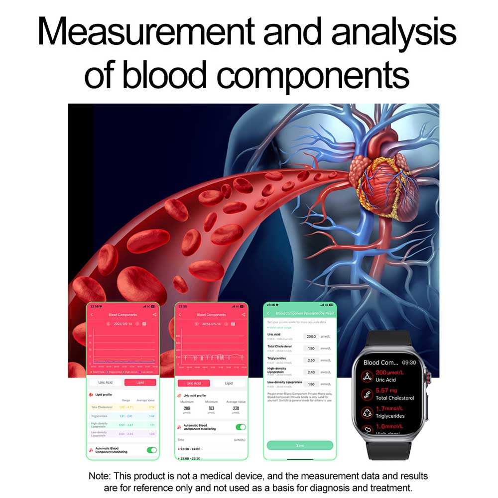 Micro-physical Examination AMOLED Smart Watch Men ECG Blood Compositoin Health Monitoring Bluetooth Call Women Sports Smartwatch