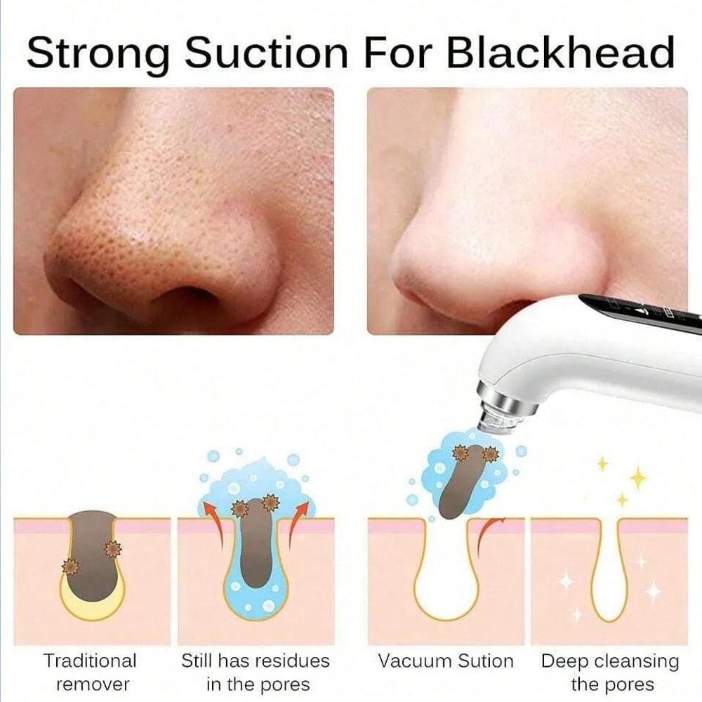 Blackhead Remover, Pore Vacuum Facial Cleaner, Electric Acne Remover, Blackhead Remover, USB Charging