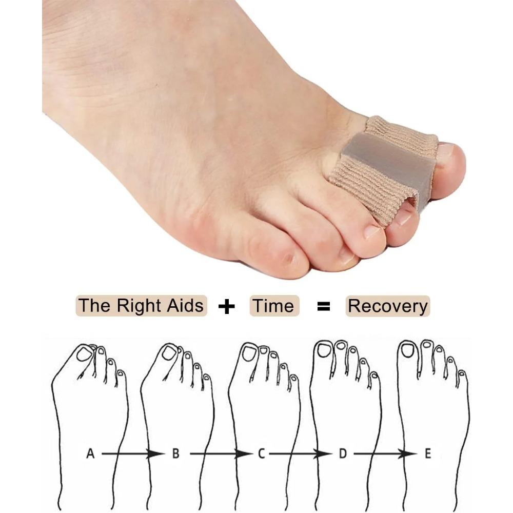 Hallux-Zehentrenner, geeignet für Männer und Frauen mit überlappenden Zehen, Gel-Zehenkorrektor, mit zwei Zehenringen (4 Stück)