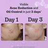 Chemist At Play 2% Salicylic Acid Face Serum For Oil Control, Pore Care And Smooth Skin Texture 30 Ml