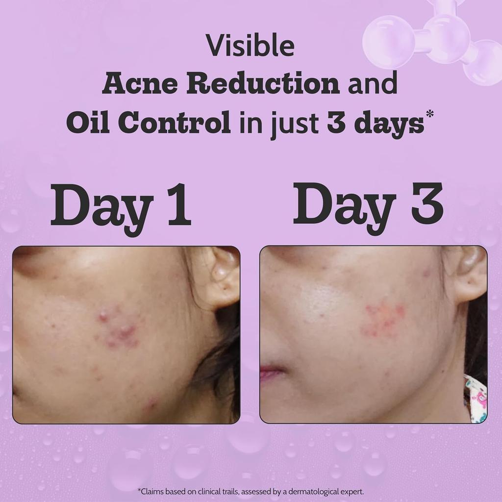 Chemist At Play 2% Salicylic Acid Face Serum For Oil Control, Pore Care And Smooth Skin Texture 30 Ml