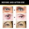 Eye Cream - Instant Tightening Eyelid Firming Cream for Anti-Aging Fine Lines & Under Eye Tightening