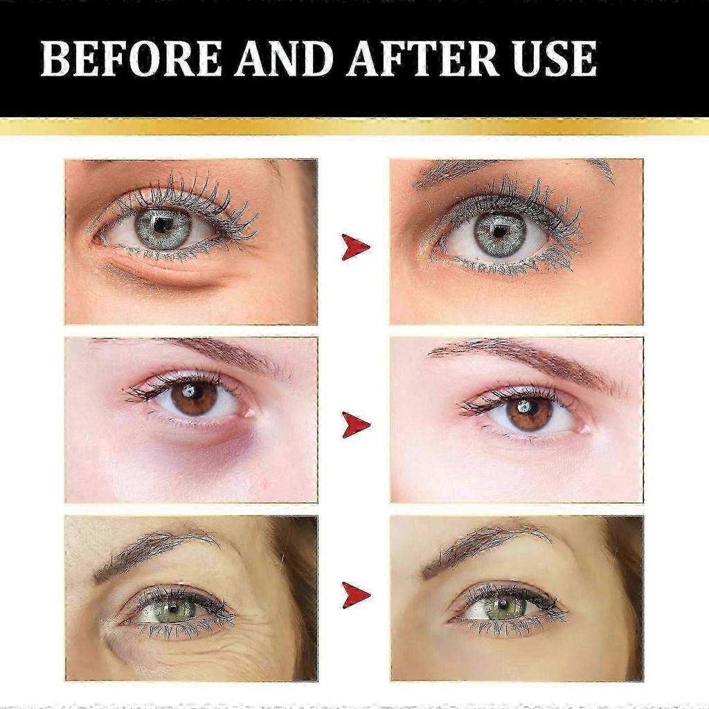 Eye Cream - Instant Tightening Eyelid Firming Cream for Anti-Aging Fine Lines & Under Eye Tightening
