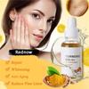 Turmeric Dark Spot Corrector Serum, Natural Turmeric Dark Spot Corrector Serum for Face, Skin Care Moisturizing Serum, Formulated with hyaluronic acid