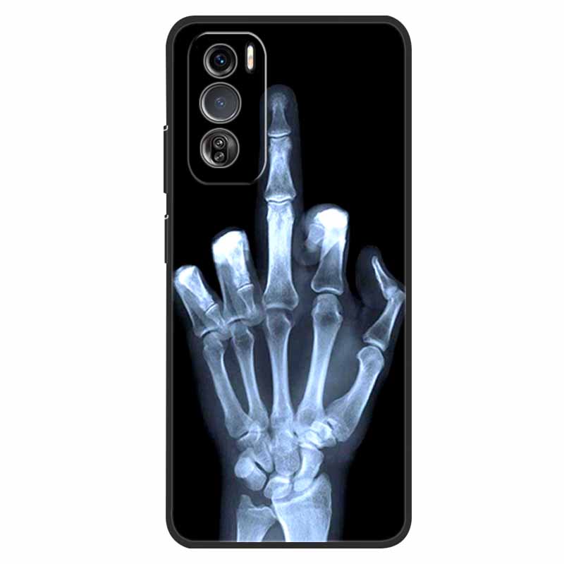 For Oppo Reno12 Pro Case TPU Animals Soft Silicone Back Cover Phone Cases For Oppo Reno 12 Pro 5G Wolf Protective CPH2629 funda