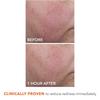 DR. Dennis Gross Blur + Repair Creme Hyaluronsäure   Peptide 1,7 oz