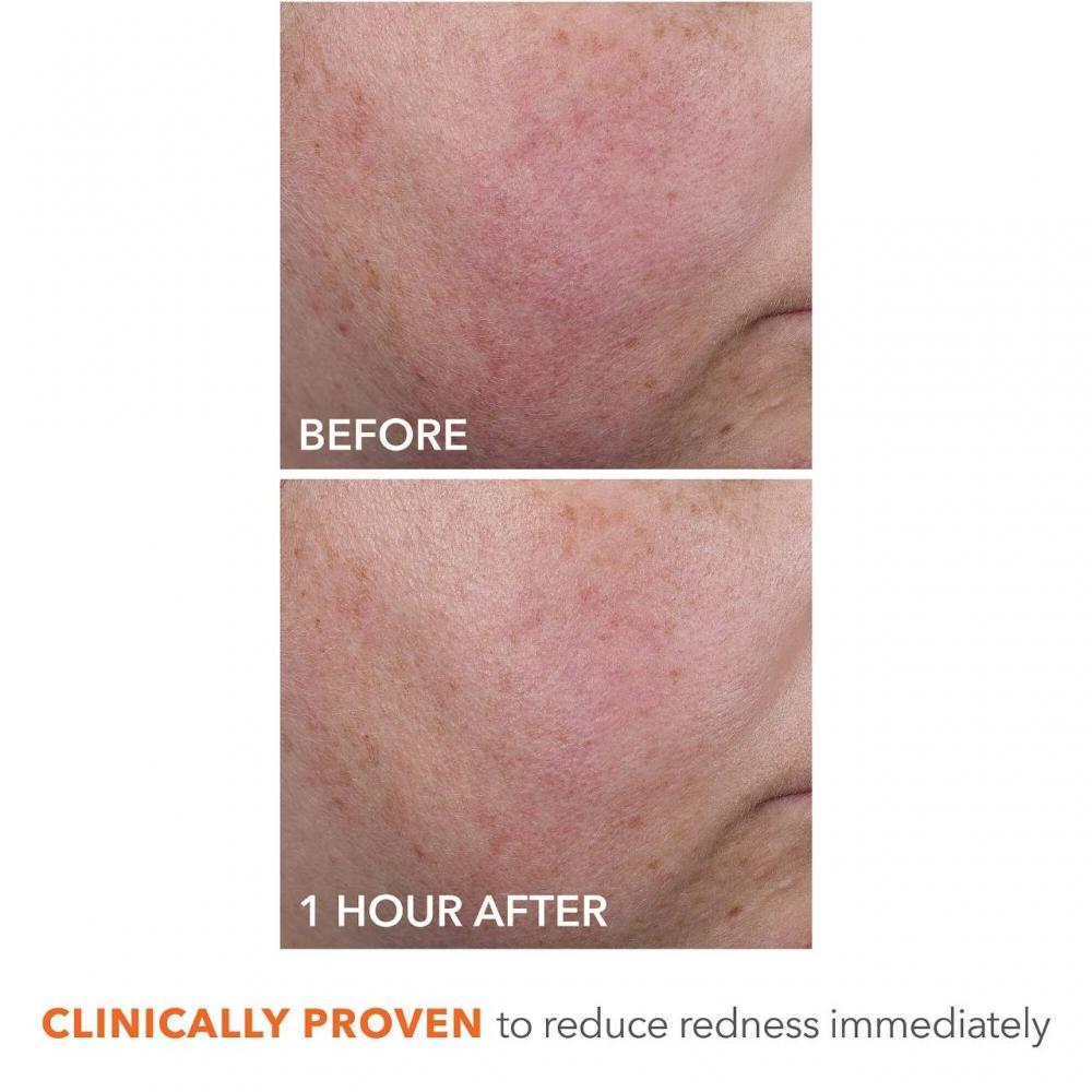 DR. Dennis Gross Blur + Repair Creme Hyaluronsäure   Peptide 1,7 oz