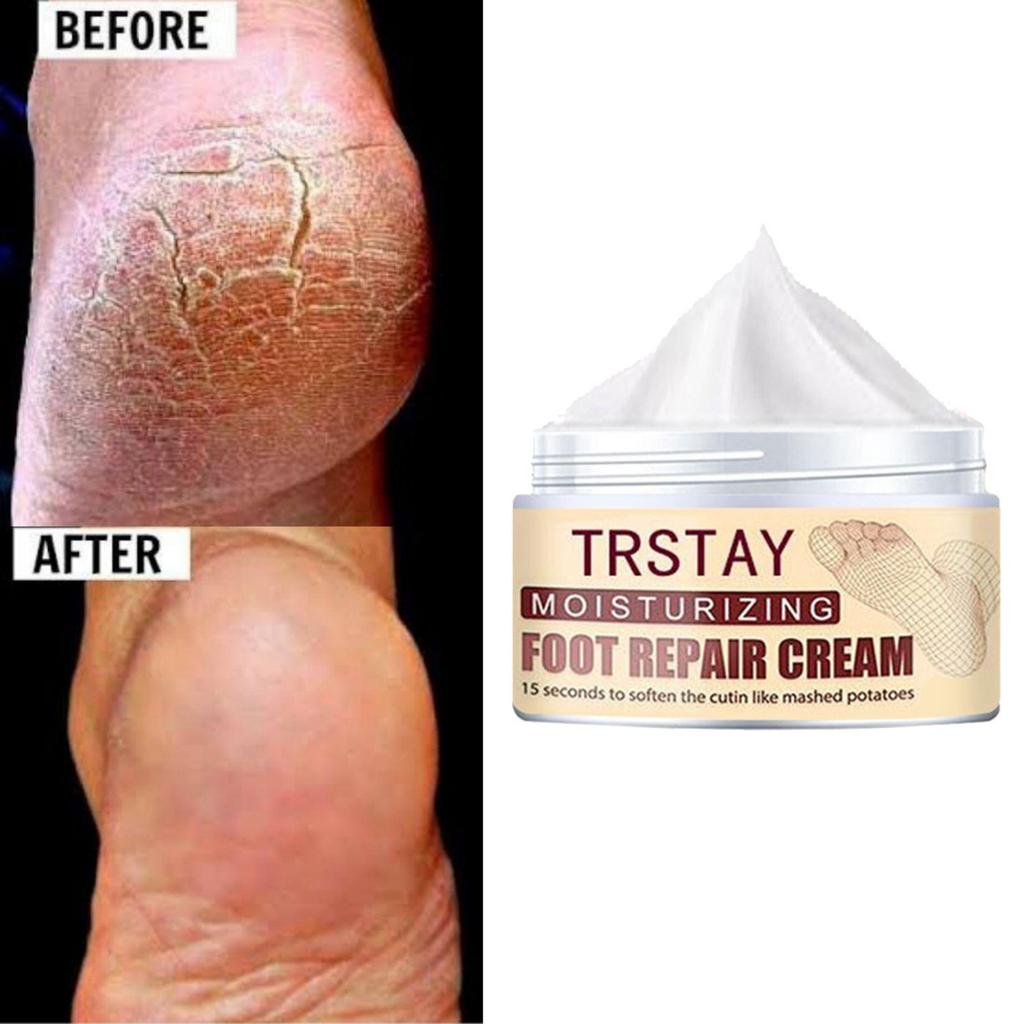 Nourishing Hand And Foot Mask Set With Moisturizing Foot Cream, For Smooth And Glowing Skin