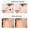 8Pcs Temporary Birthmark Concealing Sticker Skin Color Scar Concealer Sticker  Black Spot