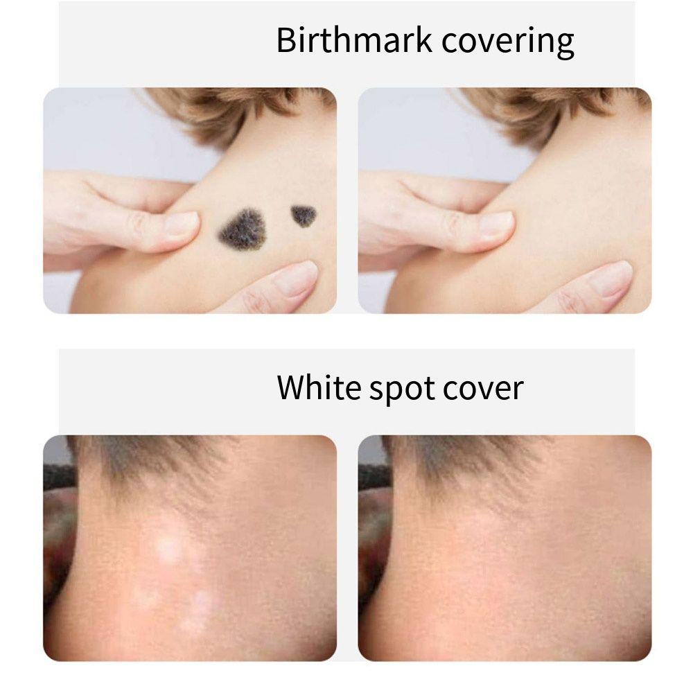 8Pcs Temporary Birthmark Concealing Sticker Skin Color Scar Concealer Sticker  Black Spot
