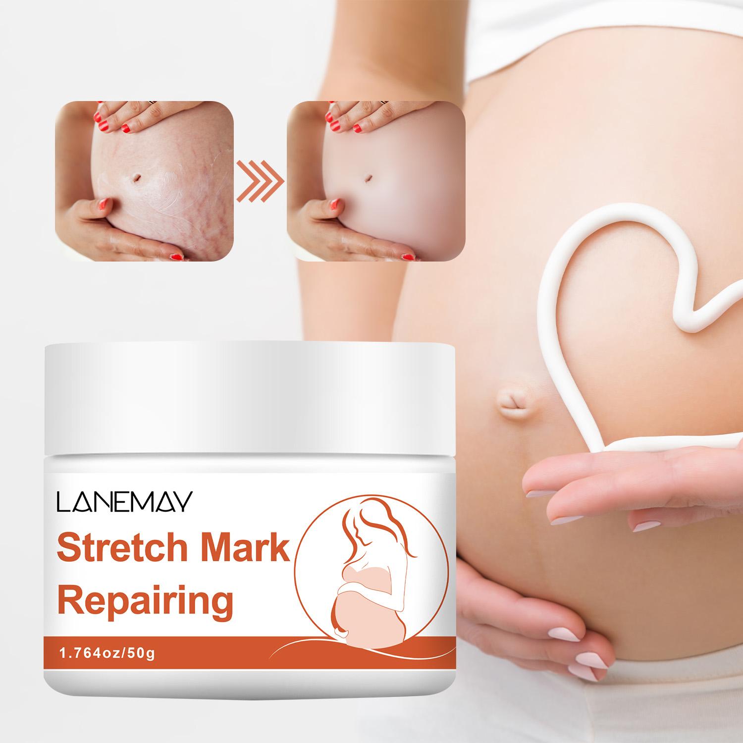 

Stretch Mark Repairing-Long Lasting Skin Tenderness-Inhibit The Growth Of Striae Gravidarum-Safe To Use For Pregnant Women, 50g