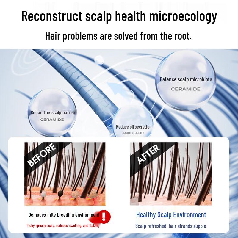 GreenKosy Sea Salt Oil Control Anti-Dandruff Shampoo