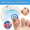 Nail Fungus Cleaning Device for Toenails & Fingernails, Foldable Nail Fungus Light Treatment Device, Suitable for Discolored and Thickened Toenails