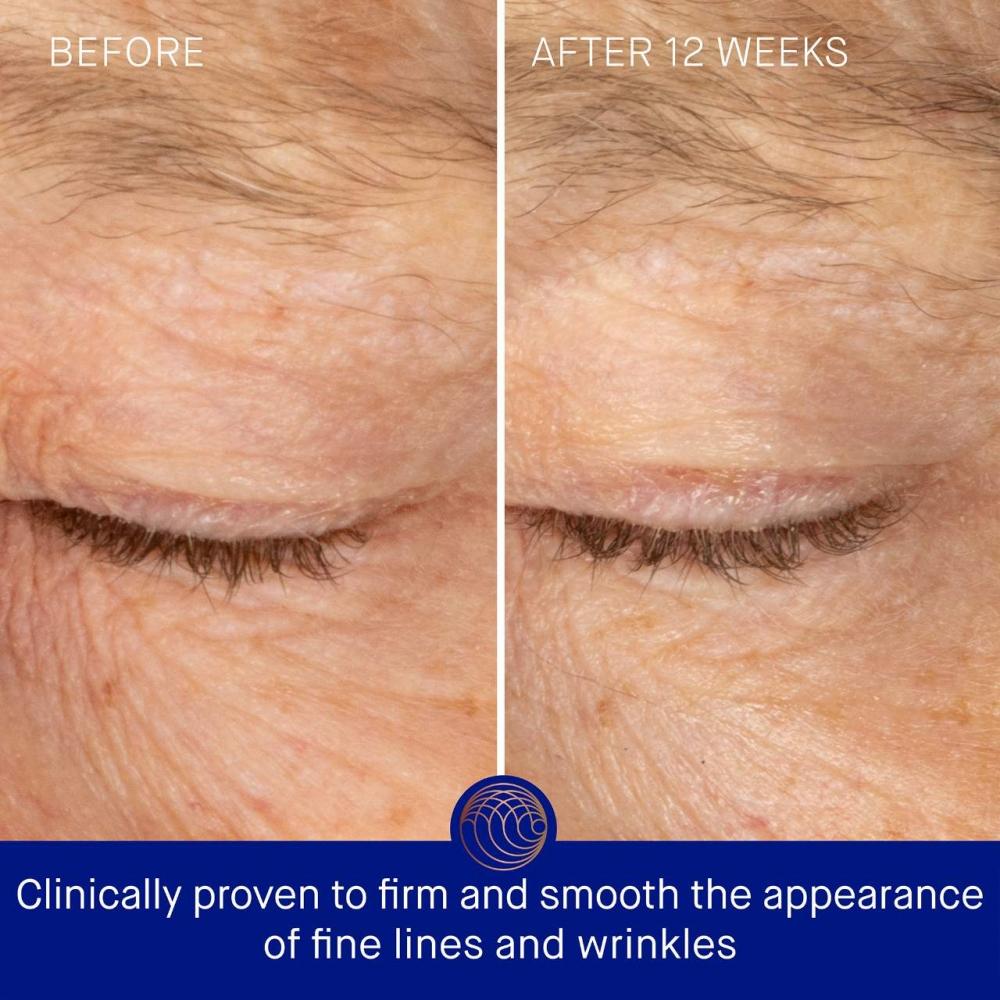 Augustinus Bader The Rich Eye Cream 15 Ml