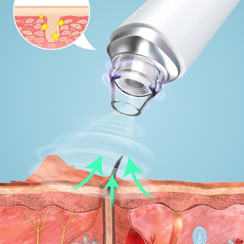 Multi Speed Pore Vacuum Cleaning Blackhead Remover For Face With Intelligent Suction Control And Reusable Tips
