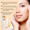 Eye Fat Granules Removal Eyestick Anti-Puffiness Firming Cream Anti Inflammatory Fade Fine Line Repair Skin Barrier Skin Care