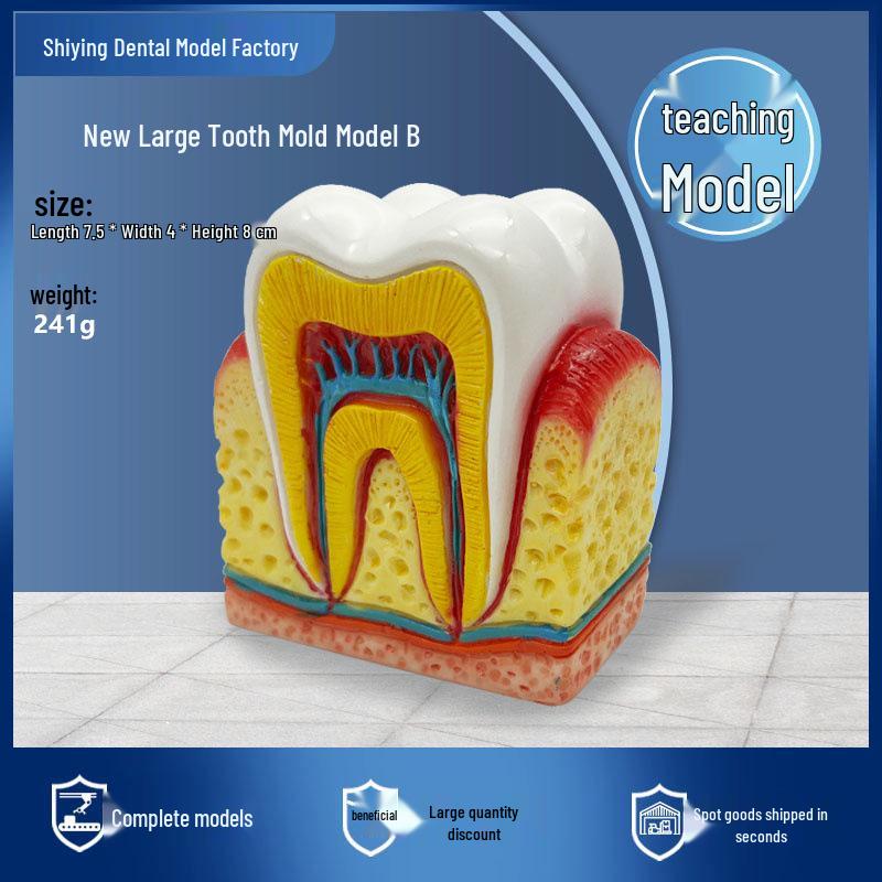 Dental Model: 6x Magnified Molar with Pulp & Nerve for Patient-Doctor Demonstration Other
