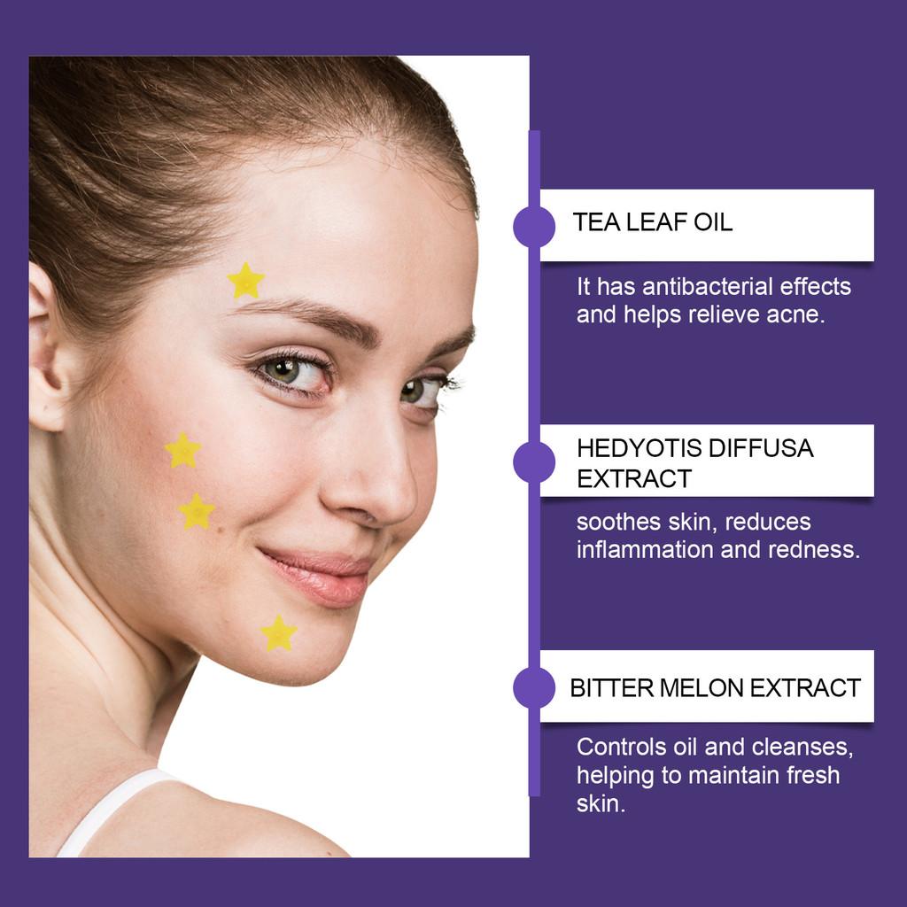 Jaysuing Colorful Acne Patches For Flawless Skin Smooth Comfort And Effective Coverage