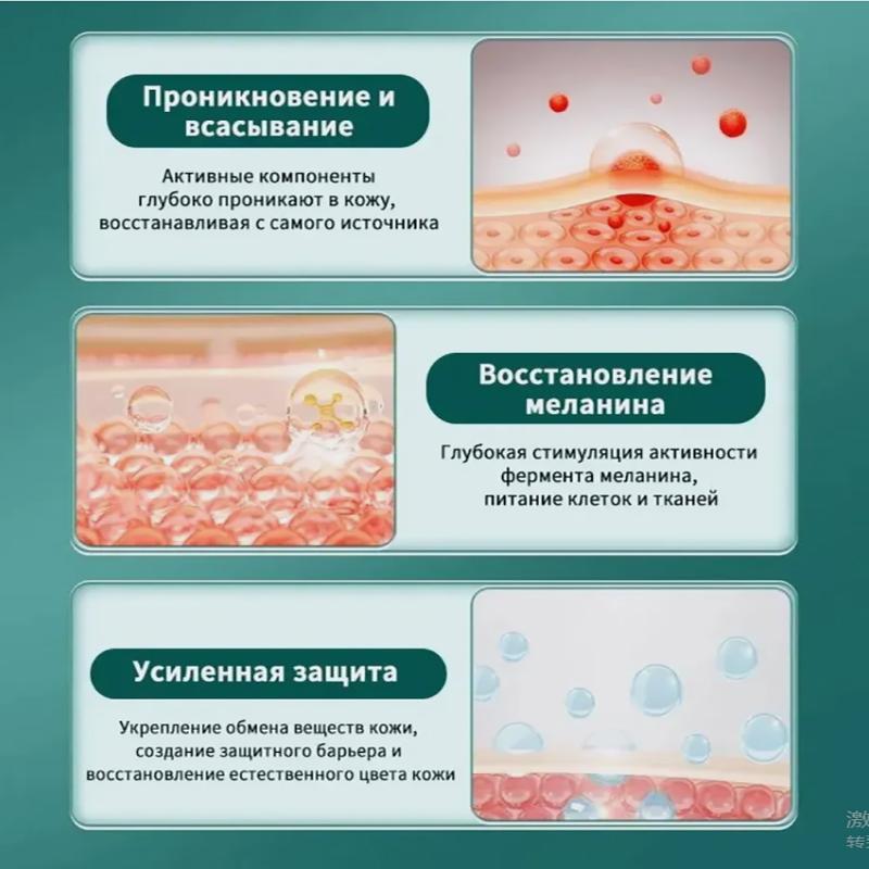 Vitiligo Relief Cream, Skin Care Cream, Vitiligo Cream, Improves Dryness, Suitable For All Skin Types