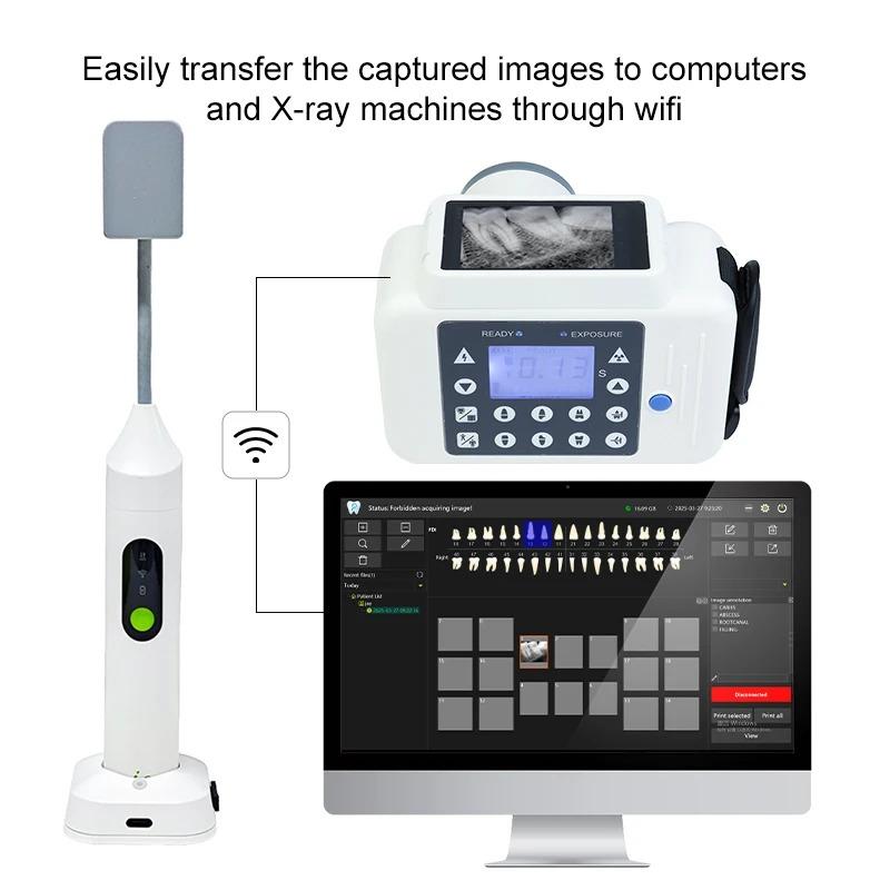 IRay Dental Drahtloser Intraoraler Sensor Digitales Bildgebungssystem Pluto 0002XW
