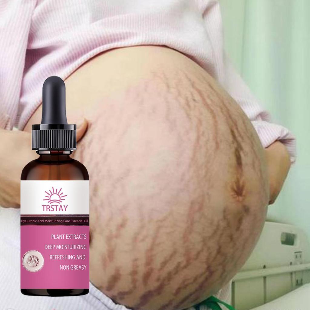 Stretch Mark Cream Scar Cream Pregnancy Cream Maternity Cream 30ml Scar Removal Repair Cream Repairs Firming Skin