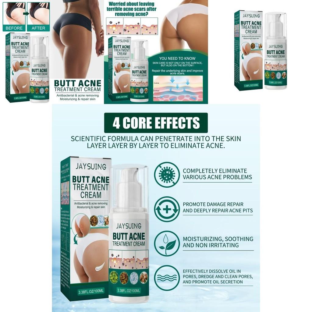 Jaysuing Butt Care Cream Nourishing Moisturizing Formula For Clear And Smooth Skin