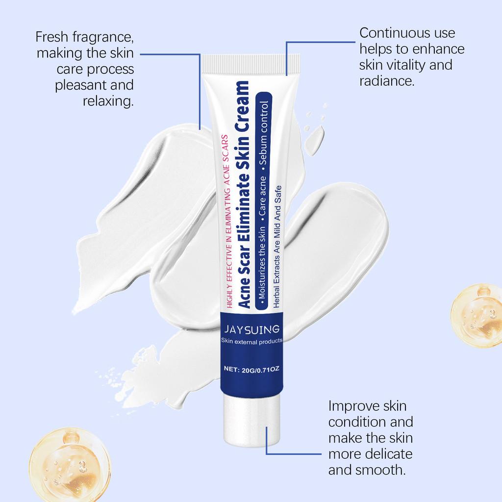 Jaysuing Herbal Acne Cream Refreshing Oil Control Gentle Cleansing Moisturizer For Skin