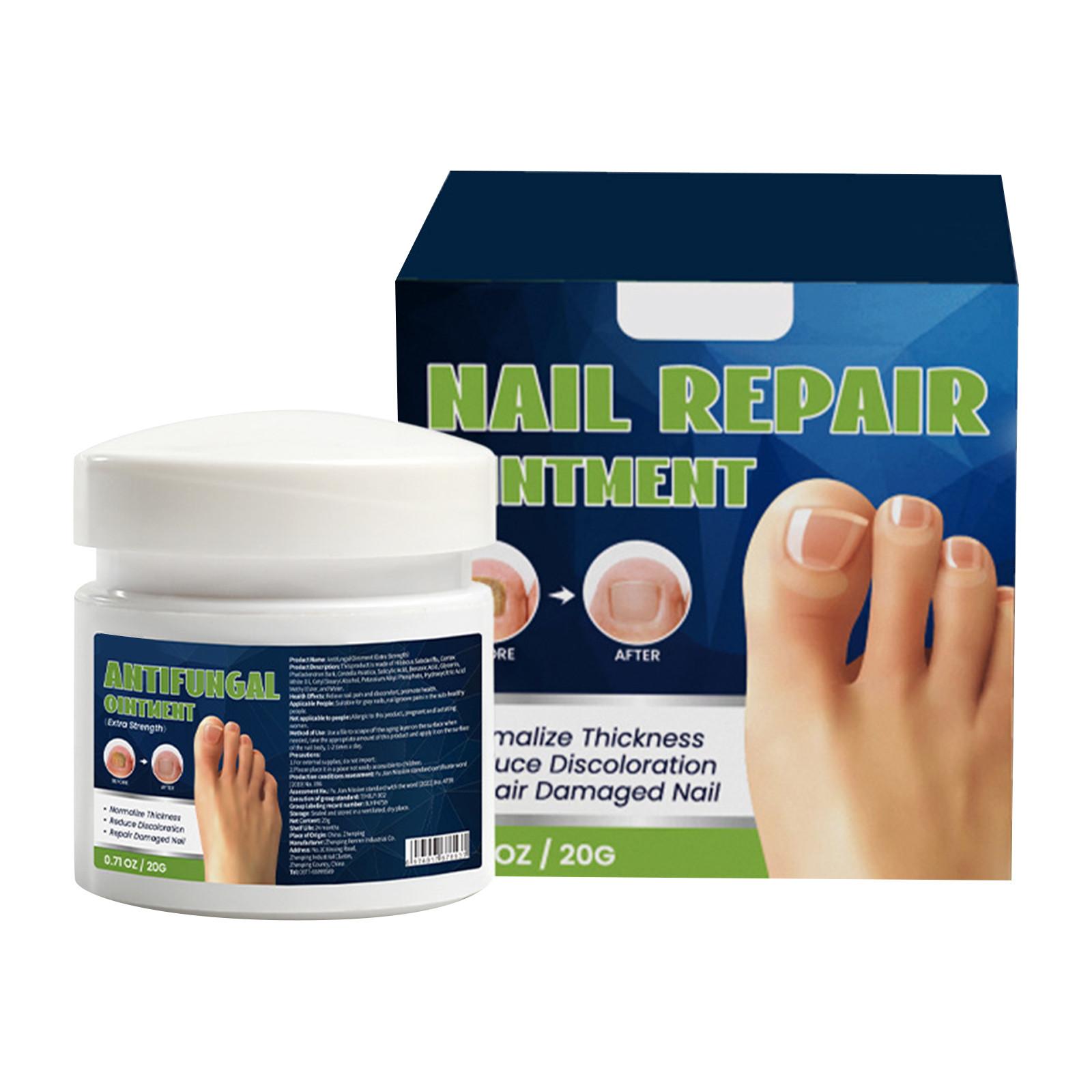 

Крем от онихомикоза, крем, очищающее средство от онихомикоза, новая осветляющая мазь