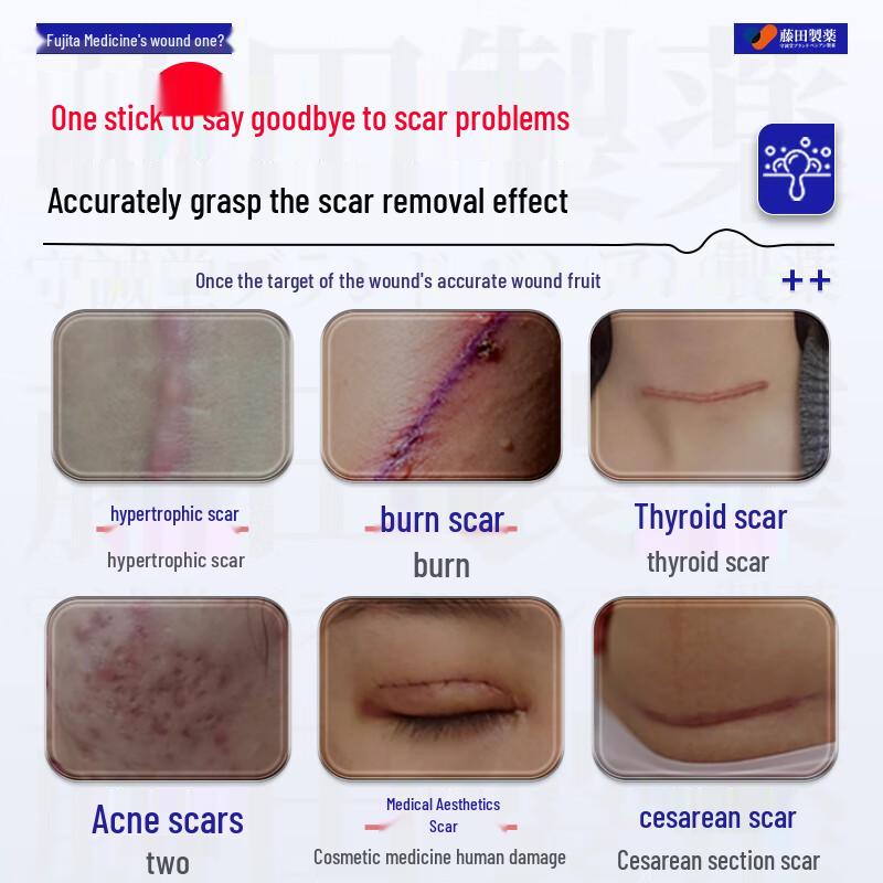 Fujita Pharmaceutical Medical Silicone Scar Repair Cream