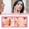 Niacinamide Watermelon Extract Cream Face Redness Nourishing Skin Moisturizing Brightening Cream