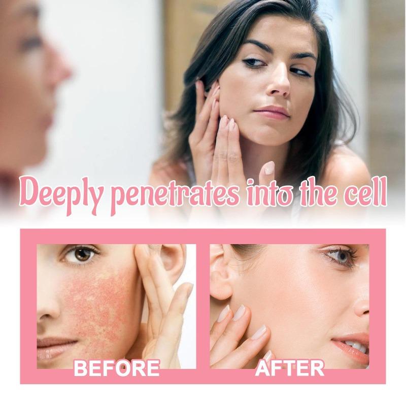 Niacinamidă Cremă cu extract de pepene verde Roșeață Feței Cremă hidratantă hidratantă pentru piele