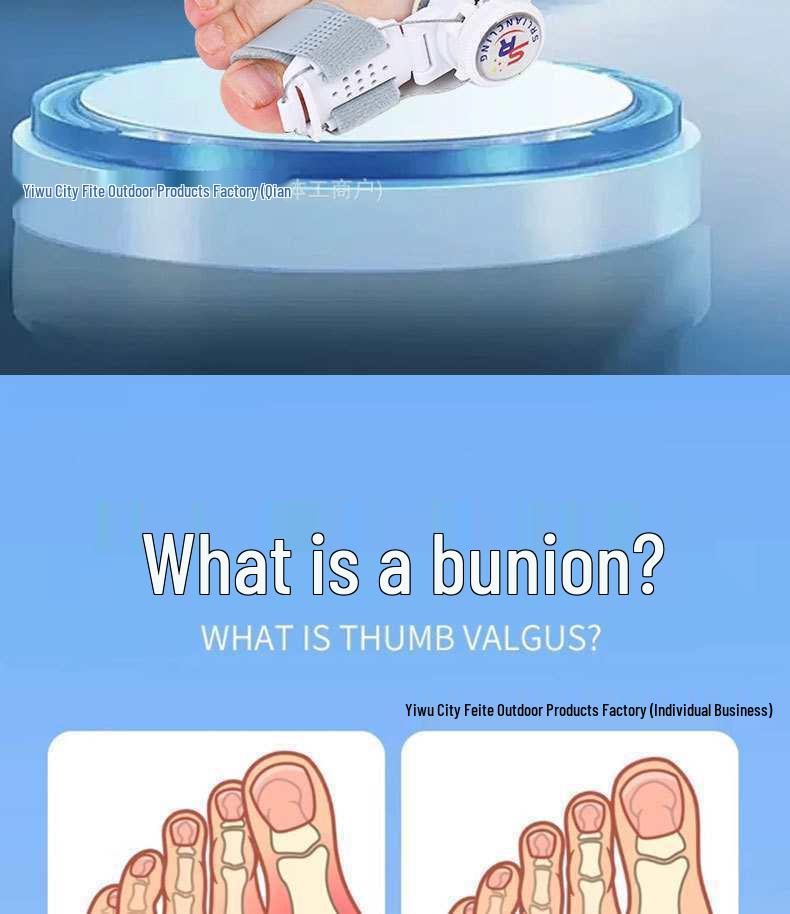 Adjustable Hallux Valgus Corrector for Foot Comfort and Alignment