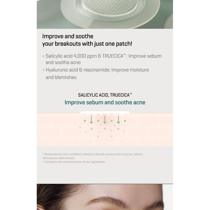 SOME BY MI - Micro Pin Spot Patch