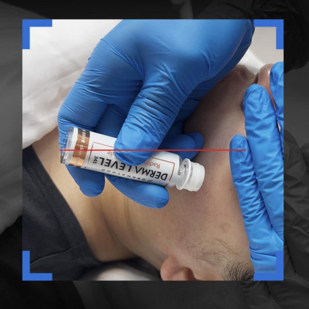 [DERMATHOD] Derma EZ Jet Multi Effector Ampoule 4ml MTS Home Care Set