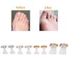 8pcs Silicone Nail Art Toe Separator Washable Reusable Toe Separation Tool Pedicure CareMY-02