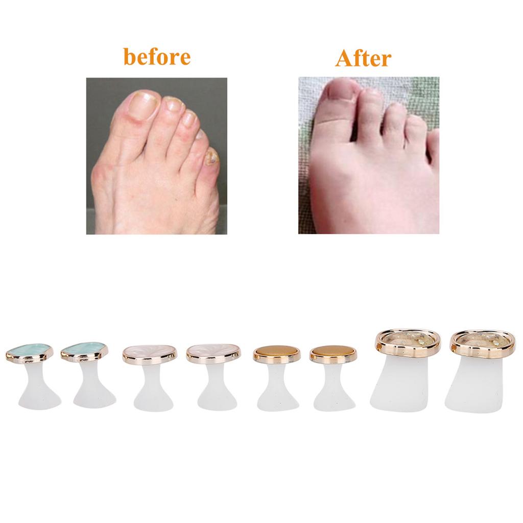 8pcs Silicone Nail Art Toe Separator Washable Reusable Toe Separation Tool Pedicure CareMY-02