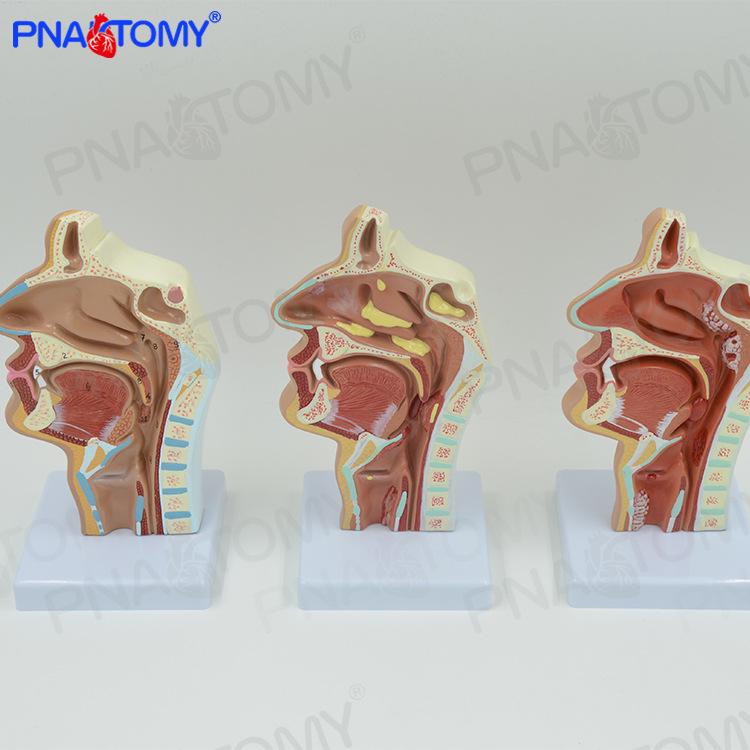 Anatomical Model of Nasal, Oral, Pharynx, and Larynx for Otolaryngology Teaching 11 x 11 x 18 cm