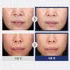 [Ilyang Pharmaceutical] Dr. Primetic Wrinkle Whitening Cream Sensitive Skin Dark Spot Brightening Cream