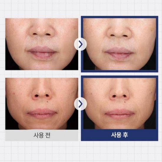 [Ilyang Pharmaceutical] Dr. Primetic Wrinkle Whitening Cream Sensitive Skin Dark Spot Brightening Cream