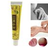 3 Pcs Cream Effective Odorless Lightweight Eczema Dermatitis Chinese Herbal Cream for Daily