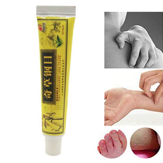 3 Pcs Cream Effective Odorless Lightweight Eczema Dermatitis Chinese Herbal Cream for Daily