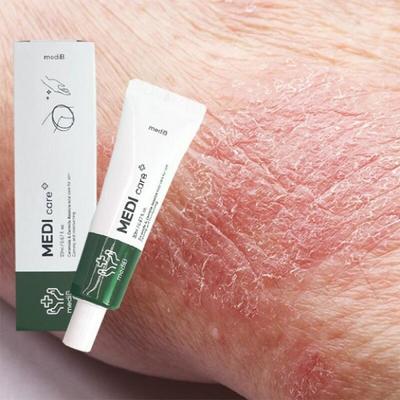Dry Skin, Itching, Tickling, Heat Rash, Eczema Ointment Cream