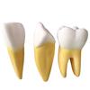 Human Tooth Anatomy Model for Teaching and Simulation - Detachable Denture Mold