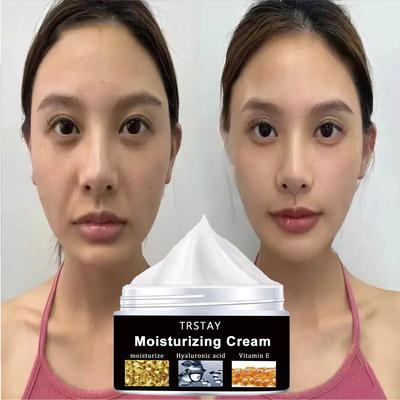 Feuchtigkeitsspendende Gesichtscreme mit Retinol-Kollagen, mild und nicht reizend, spendet der Haut Feuchtigkeit und befeuchtet sie