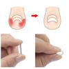 1Pcs Nail Correction Stickers Ingrown Toenail Corrector Patches Invisible High Strength Auxiliary Patch Paronychia Treatment