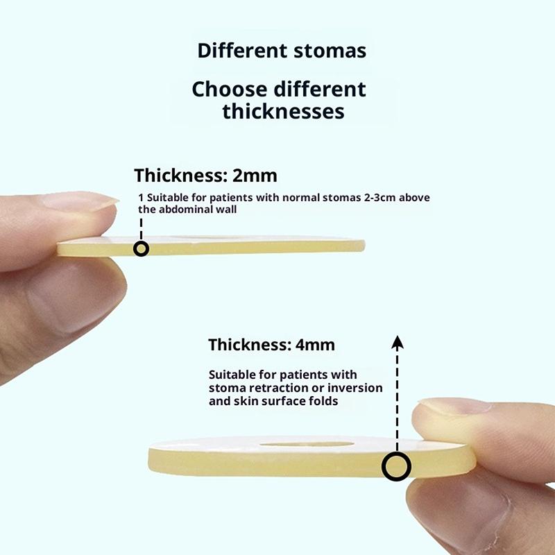 10Pcs Anti-Leakage Leak-Proof Ring For Colostomy Bag Ostomy Paste Ring Baseplates Stoma Care Products To Protect Skin 2/4Mm