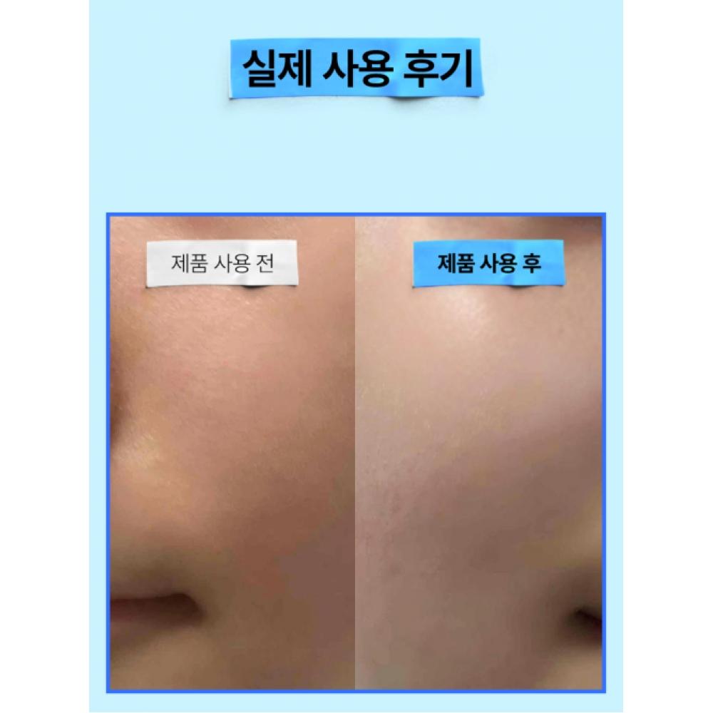 Efilow [2 Pack] Resurrection Hyaluronic Acid Quick Drying Moisture Elasticity Ampoule 50ml