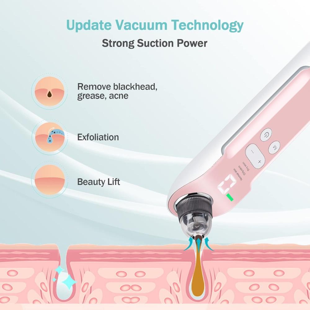 Mitesser-Vakuum, wiederaufladbar, zum Entfernen weißer Köpfe mit 3 einstellbarer Saugleistung, Mitesser-Extraktionswerkzeug mit LED-Anzeige 