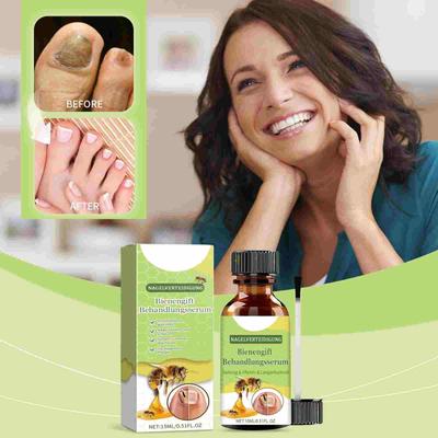 Soro para unhas, Soro para cuidados com as unhas Healthy Nails, Soro para unhas Honey Grapefruit Extract Soro para cuidados com as unhas, Cuidados com as unhas contra fungos, 15ML/0,51FL.OZ