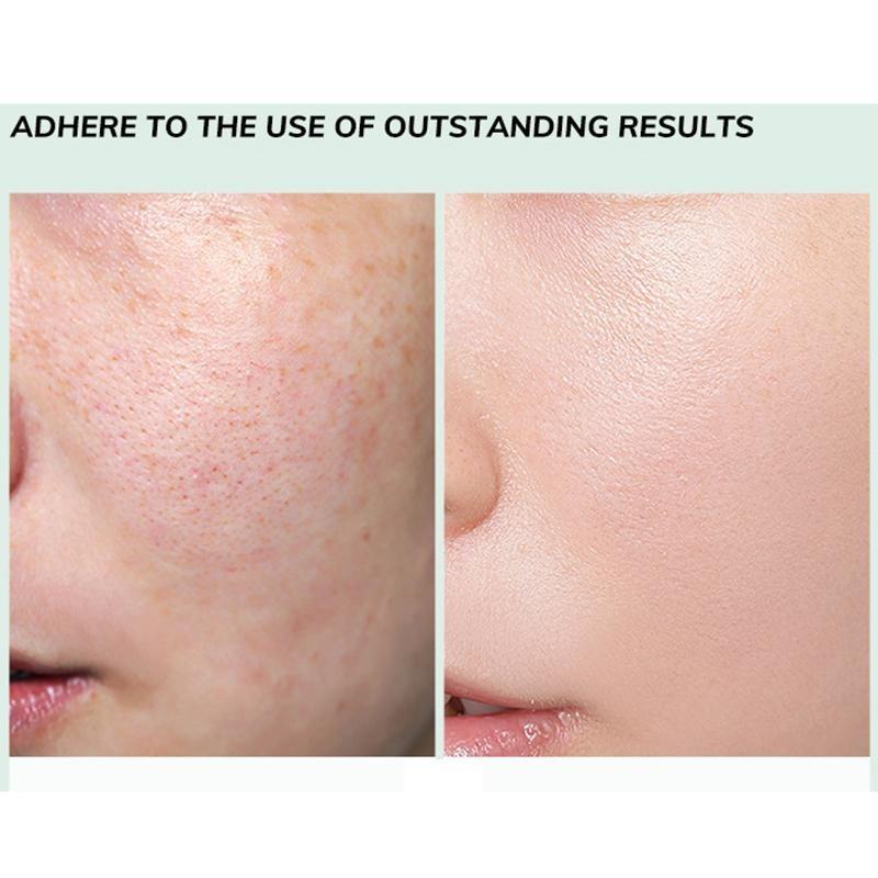 HOUMAI Aloe Vera Gel Emulsion Feuchtigkeitsspendende Körperlotion Gesichtspflege Aufhellende Haut Hautpflegeprodukte